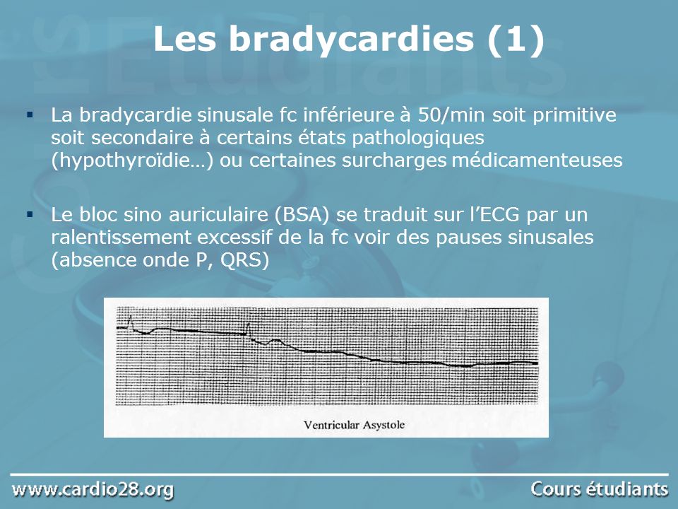 Les bradycardies